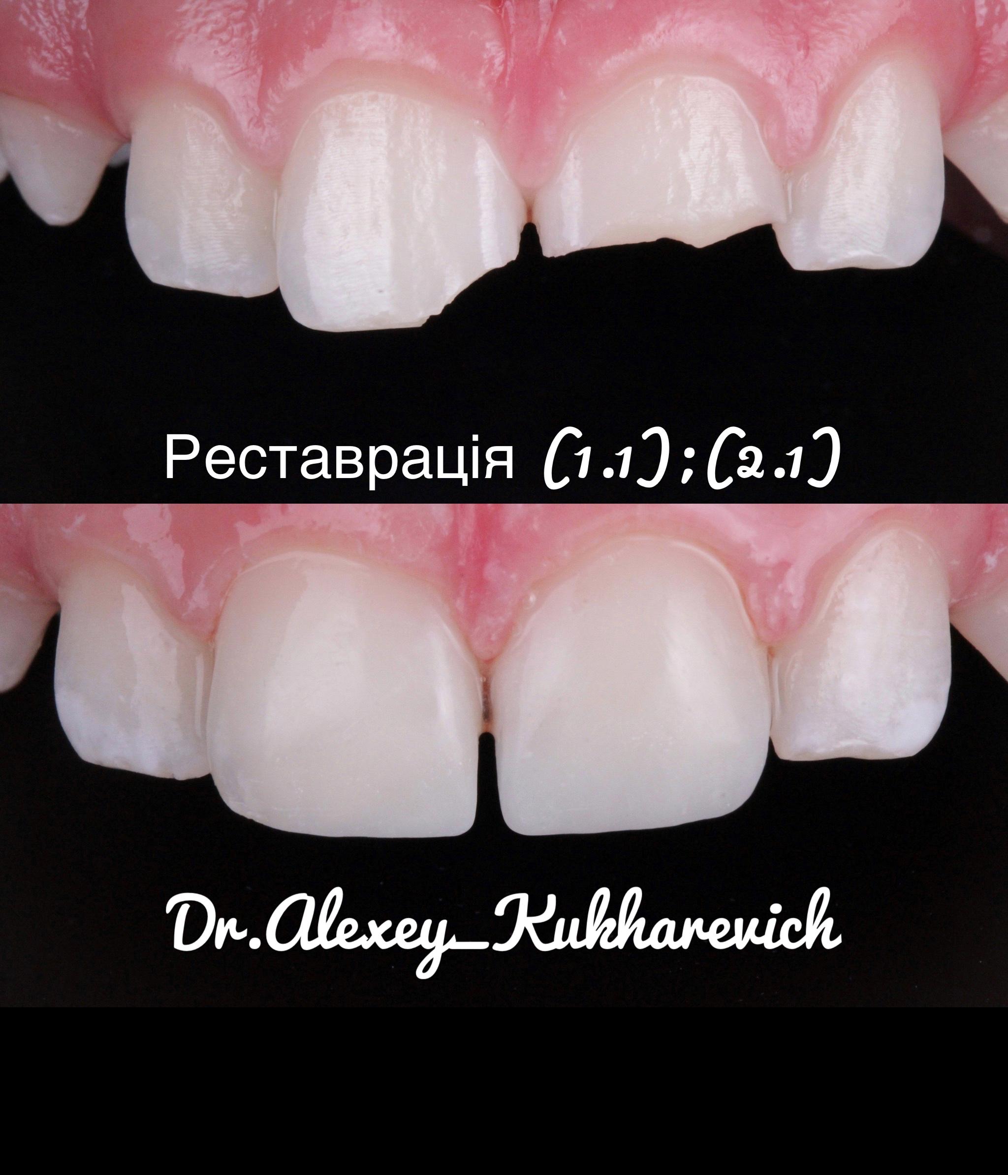 роботи, Роботи, «Амарант»  Клініка естетичної стоматології Dr.Alexey_Kukharevich